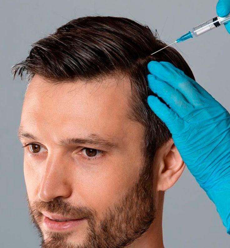 PRP hair treatment in Dubai