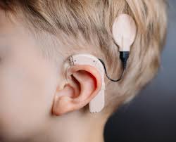 Siemens Hearing Aid Price in Pakistan