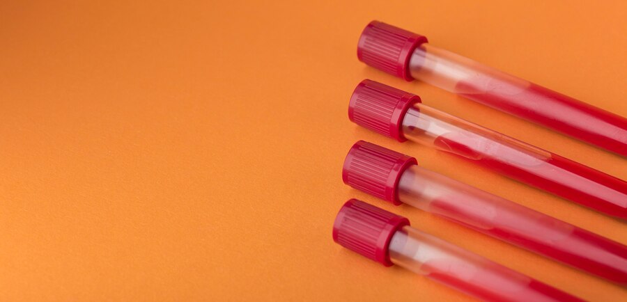 How to Book a Blood Test at Home in Noida: Step-by-Step Instructions