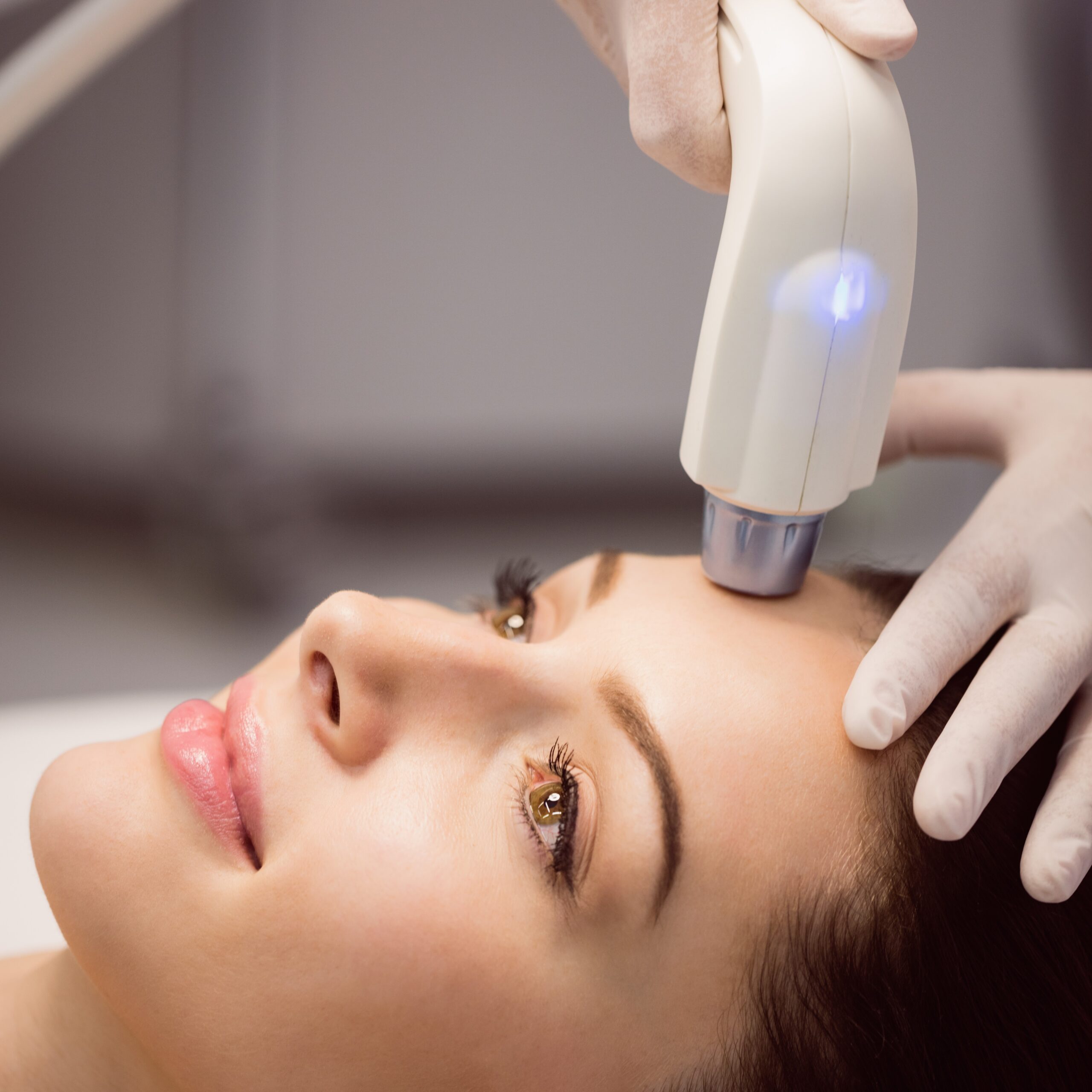 Effective Hyperpigmentation Treatment in Upminster: Restore Your Skin’s Radiance