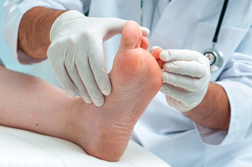 Specialized Podiatry Services in Edinburgh for Diabetic Footcare