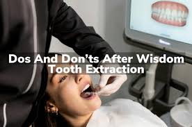 Dos and Don’ts After Wisdom Tooth Extraction